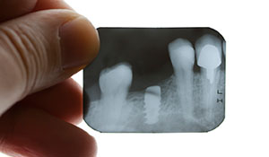 General Dentistry, Pictou County Dentist